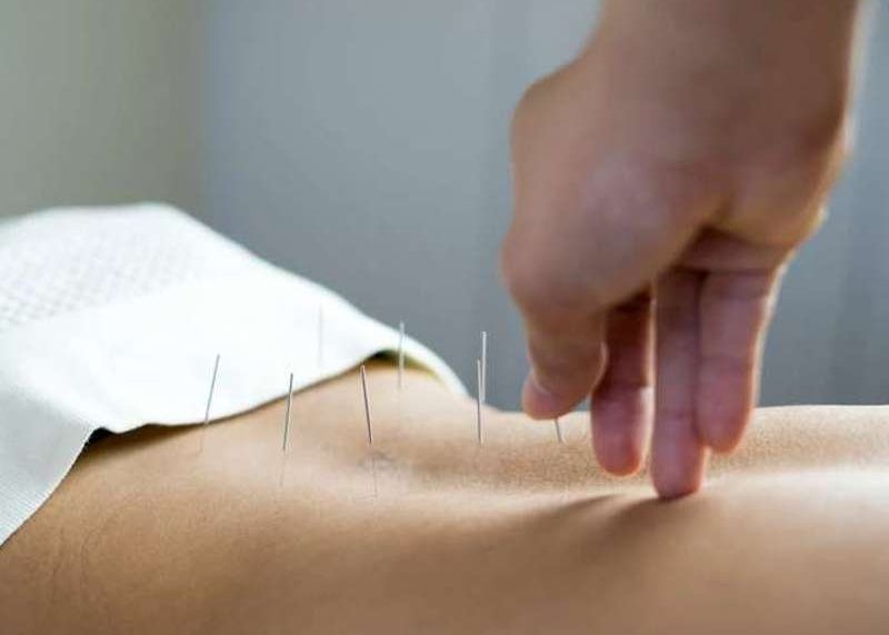 koristi akupunkture u termama su čak veće